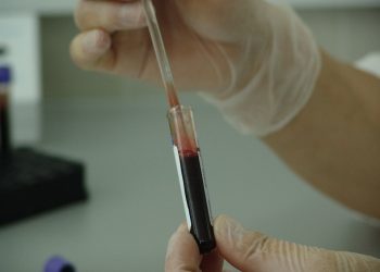Sono oltre 400 le persone che a Malta convivono con il virus HIV
