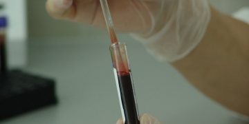 Sono oltre 400 le persone che a Malta convivono con il virus HIV
