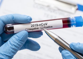 coronavirus test epidemia contagio