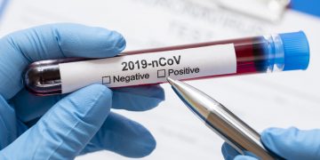 coronavirus test epidemia contagio