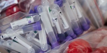 L’intervento – I contributi pubblici per la produzione di prodotti legati al COVID 19