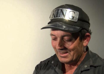 Candidato politico promette 7mila euro a donne e uomini per i “ritocchini” dal chirurgo plastico