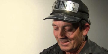 Candidato politico promette 7mila euro a donne e uomini per i “ritocchini” dal chirurgo plastico