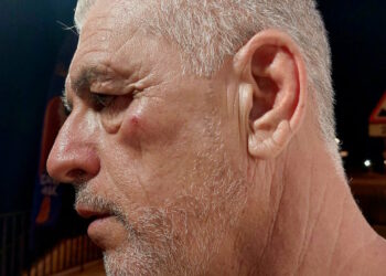 Rimproverati perché urinavano in pubblico a Sliema, si scagliano contro il sindaco a colpi di bottiglia