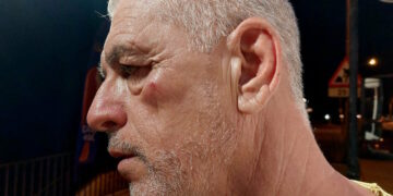 Rimproverati perché urinavano in pubblico a Sliema, si scagliano contro il sindaco a colpi di bottiglia