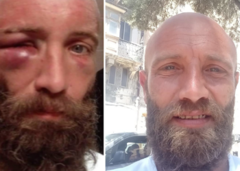 Tassista brutalmente aggredito in servizio, in tribunale emergono dubbi. Diciannovenne libero su cauzione