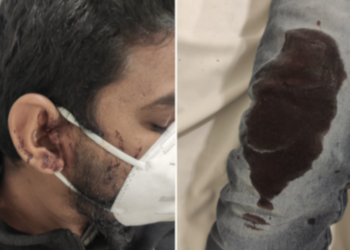 Marsa: 30enne aggredito all’alba da tre uomini. Stava rientrando da lavoro