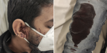 Marsa: 30enne aggredito all’alba da tre uomini. Stava rientrando da lavoro