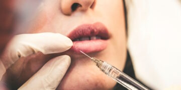 Medicina estetica, prevista introduzione IVA al 18% su diverse prestazioni non “essenziali”