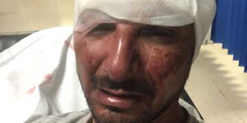 Tentava di vendere il furgone ad un compratore agganciato sui social, ma finisce in ospedale con ferite alla testa