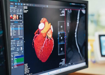 Al Gozo General Hospital introdotti esami specialistici al cuore con nuovi scanner da 5 milioni di euro