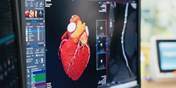 Al Gozo General Hospital introdotti esami specialistici al cuore con nuovi scanner da 5 milioni di euro