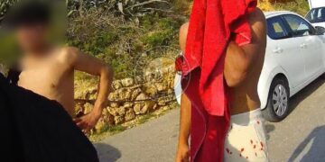 Rissa a Golden Bay, giovane gravemente ferito: arrestato un 18enne